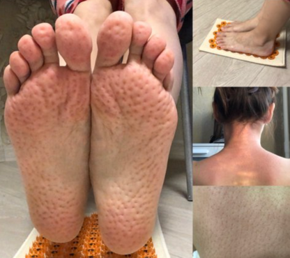 Dual Harmony™ Acupressure Mat (Kuznetsov's Applicator)